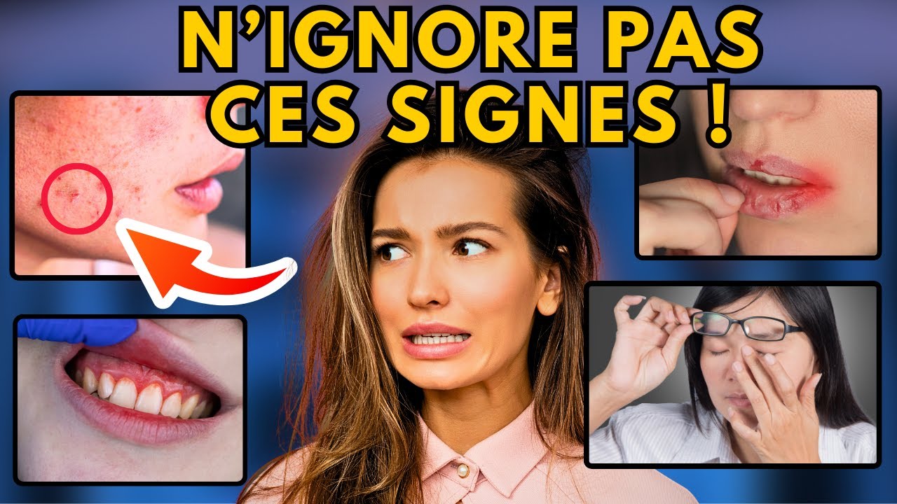 12 SYMPTÔMES d'alerte de CARENCE en NUTRIMENTS