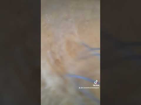 spécial pour diabétiques des crêpes sans sucre